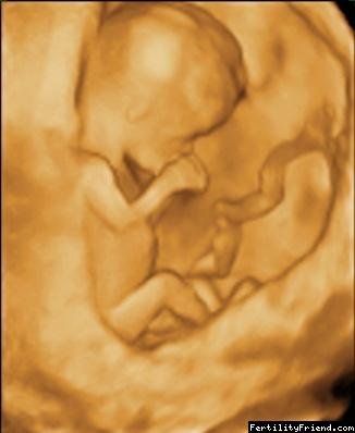 3D ultravuk 11. - 15. týden