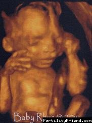 3D ultrazvuk 16. - 20. týden