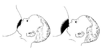 Dobré a špatné přisátí dítěte